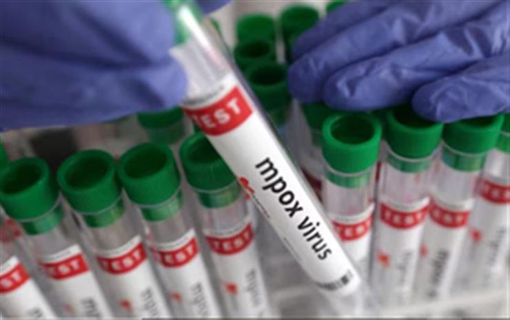 Mpox Clade 1b more infectious, increases risk of miscarriage: Study