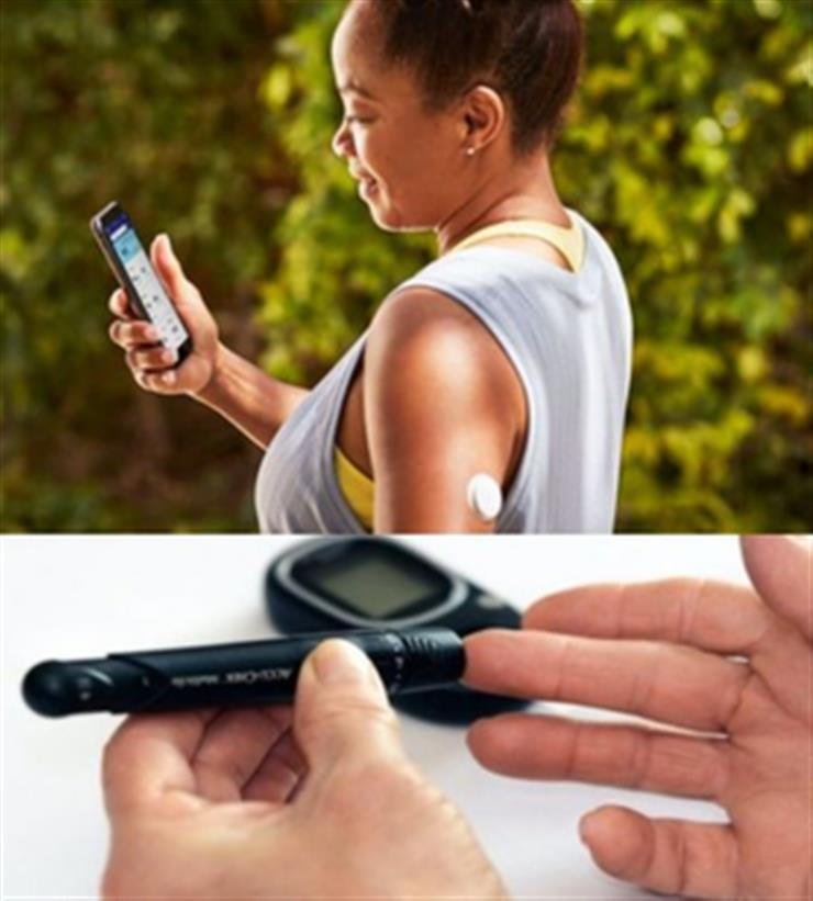 Study shows continuous glucose monitors may harm healthy adults