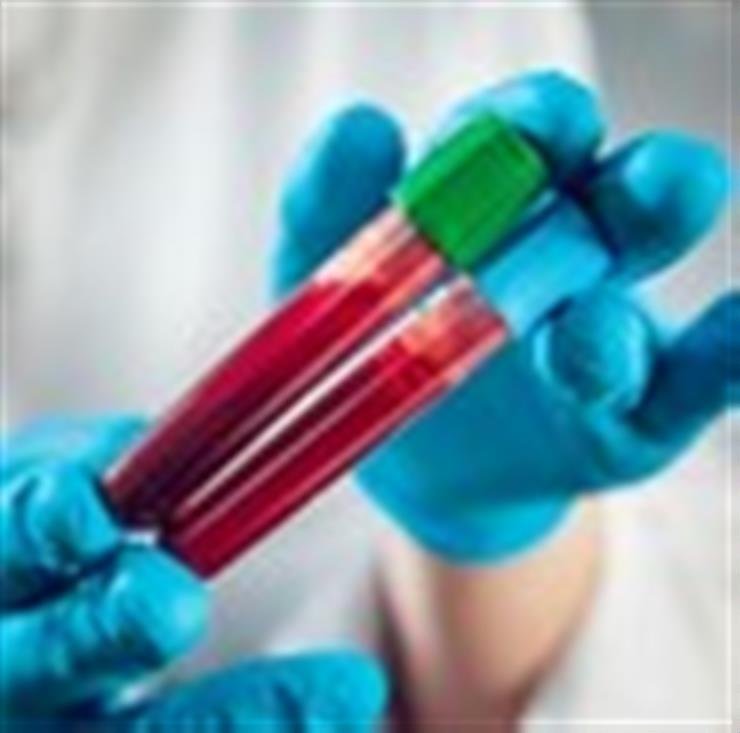 New blood test to help detect risk of 30 age-related diseases