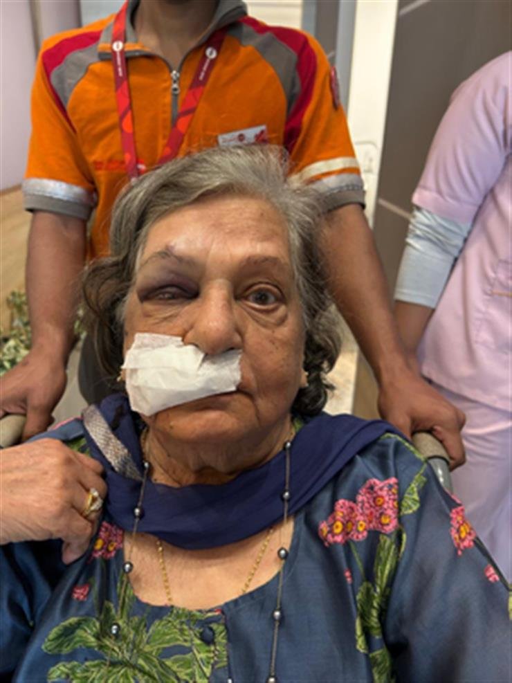 Denied wheelchair, 82-year-old woman lands in ICU; Air India reacts