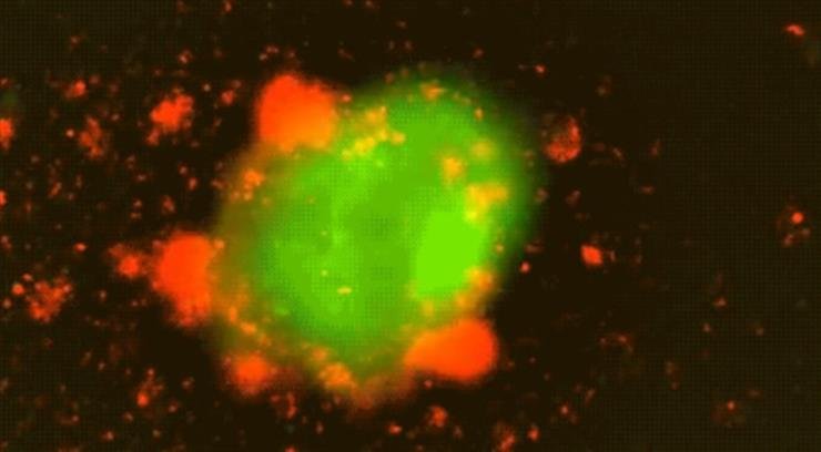 Ultrasound-activated CAR T-cell therapy to enable long-lasting tumour destruction