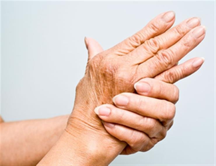 Study finds common blood fat linked to rheumatoid arthritis in women