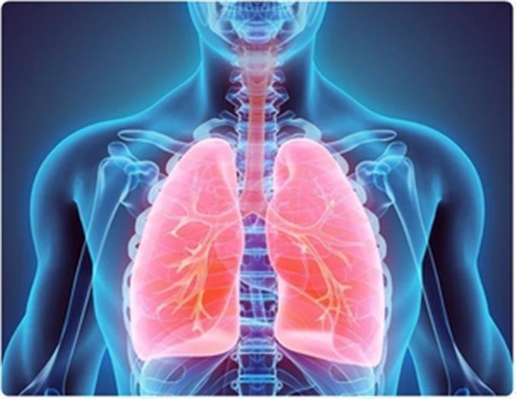 Study finds 1 in 3,000 people at risk of punctured lung from faulty gene