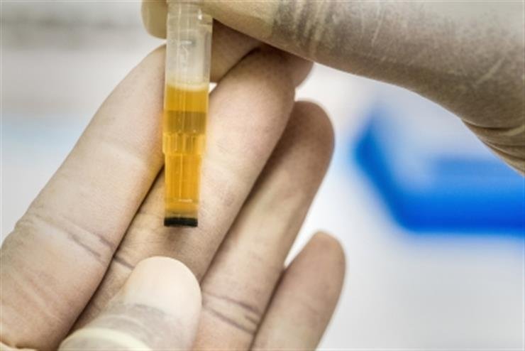 No scientific evidence to prove urine therapy can treat any disease: Experts