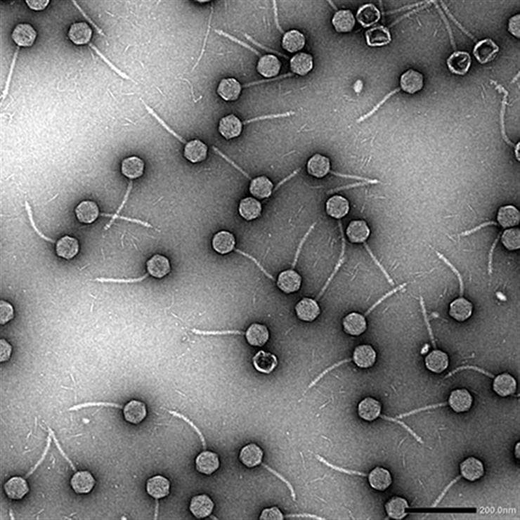 Hidden virus found common in germs that cause pneumonia: Study